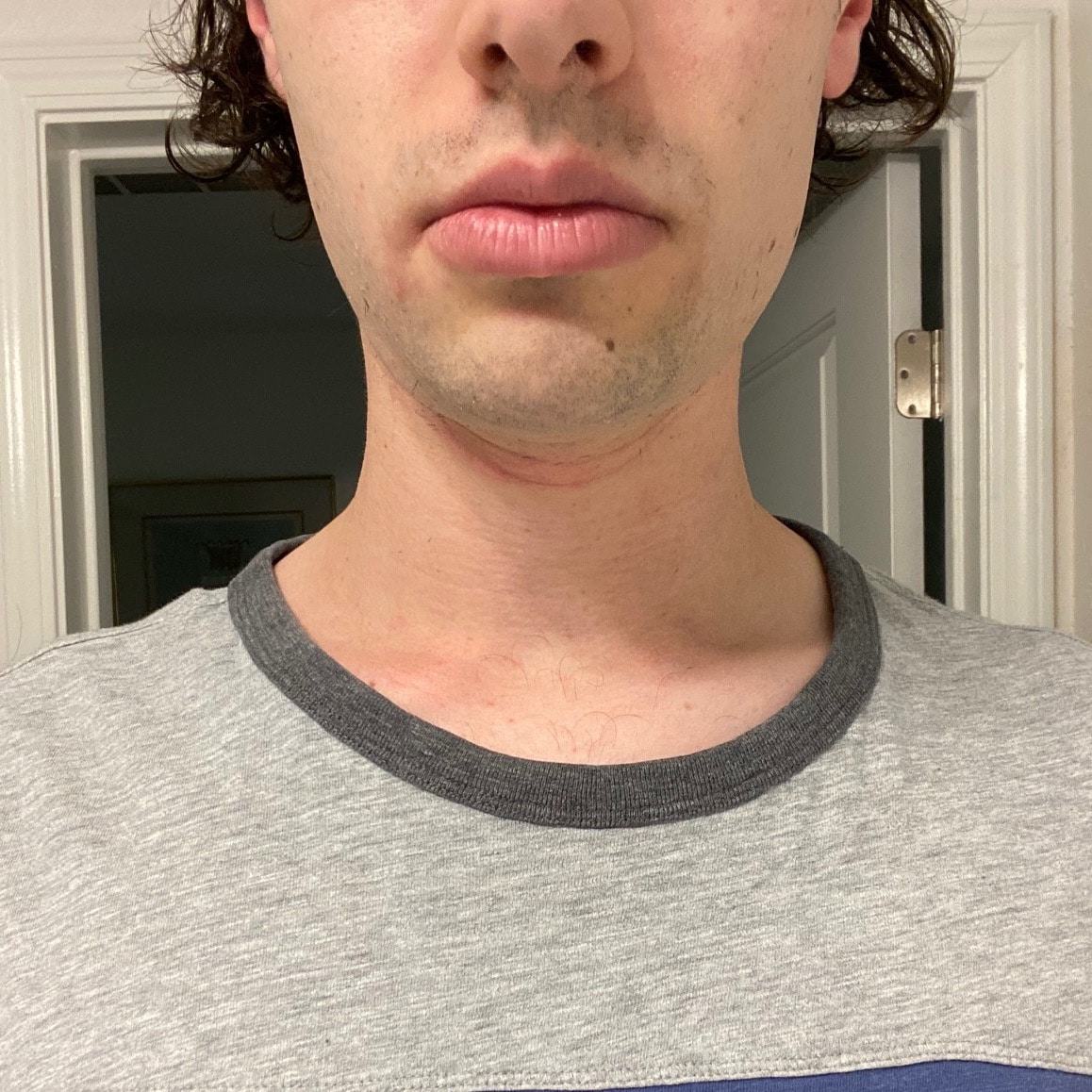 Face after shaving