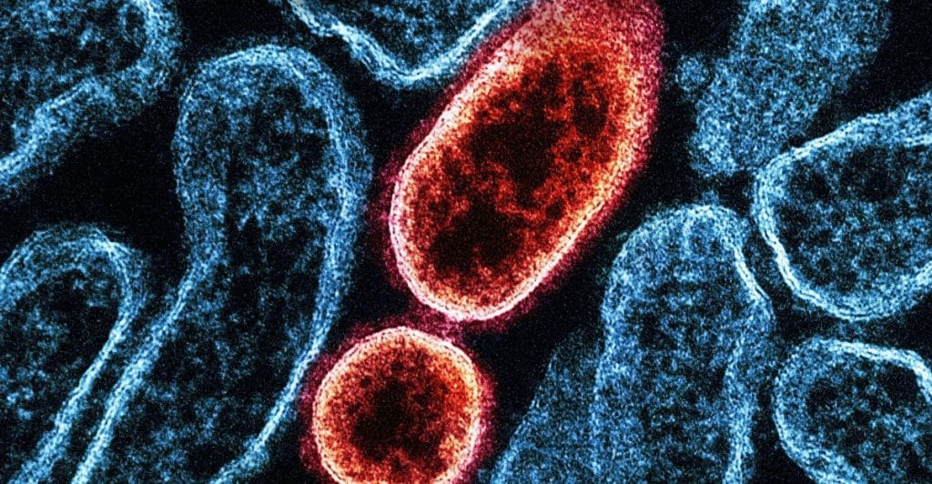 A microscopic view of various red and orange colored organisms.