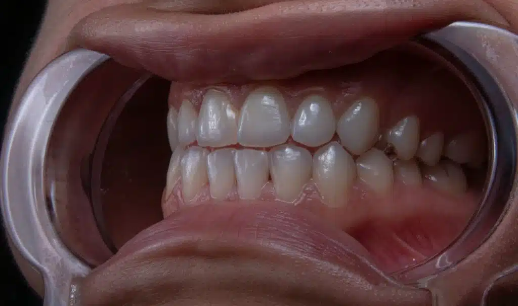 A man’s mouth widely open