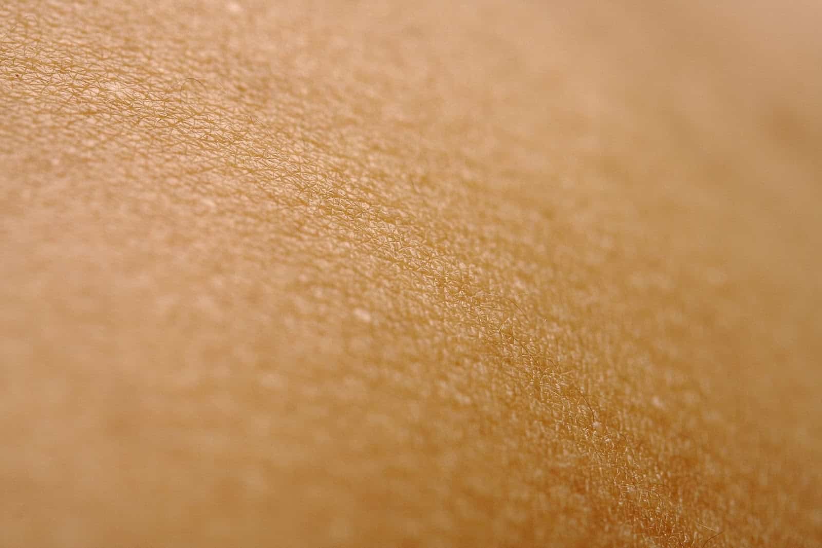 A close-up picture of a skin.