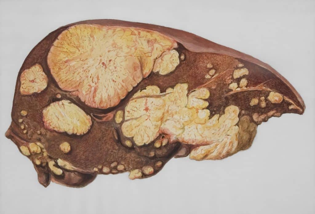A picture of a liver.