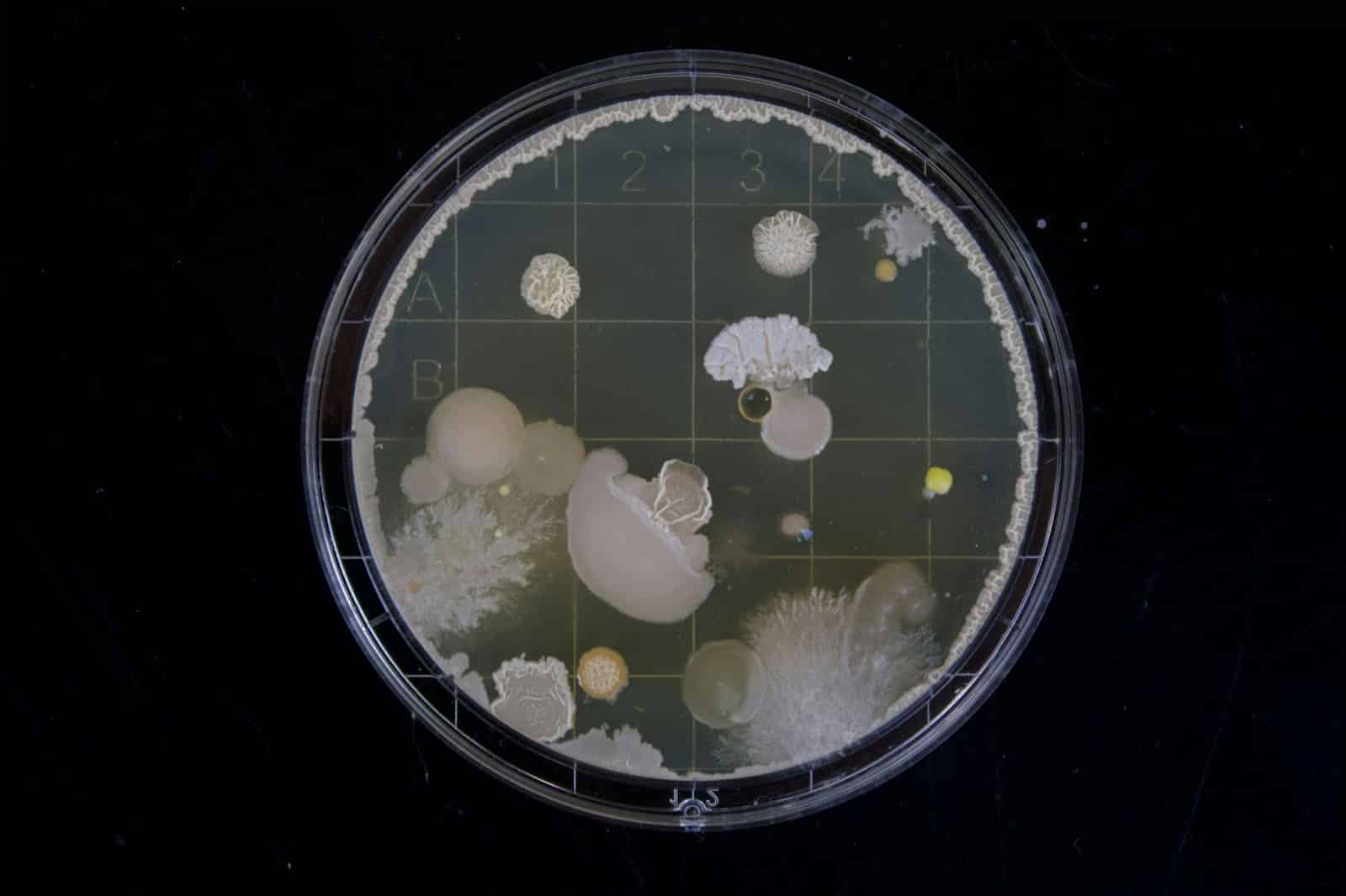 A picture of a bacteria samples.