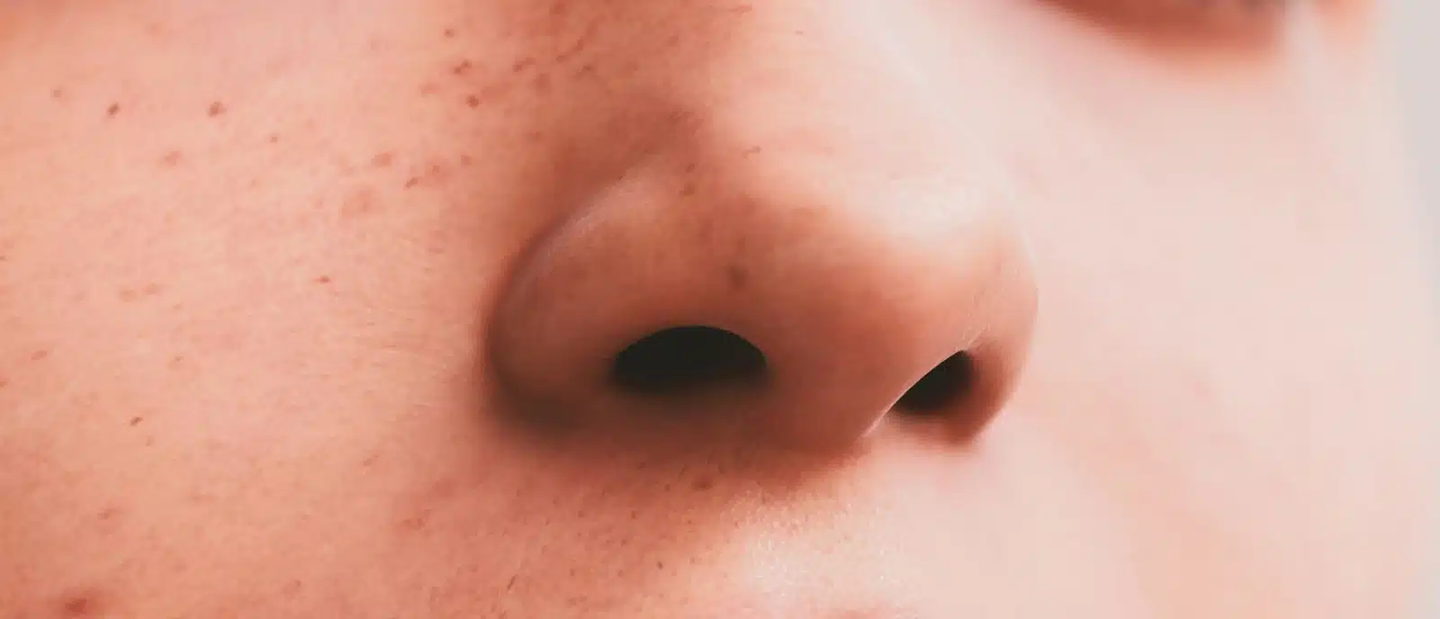 A picture of a man’s nose without a blood.