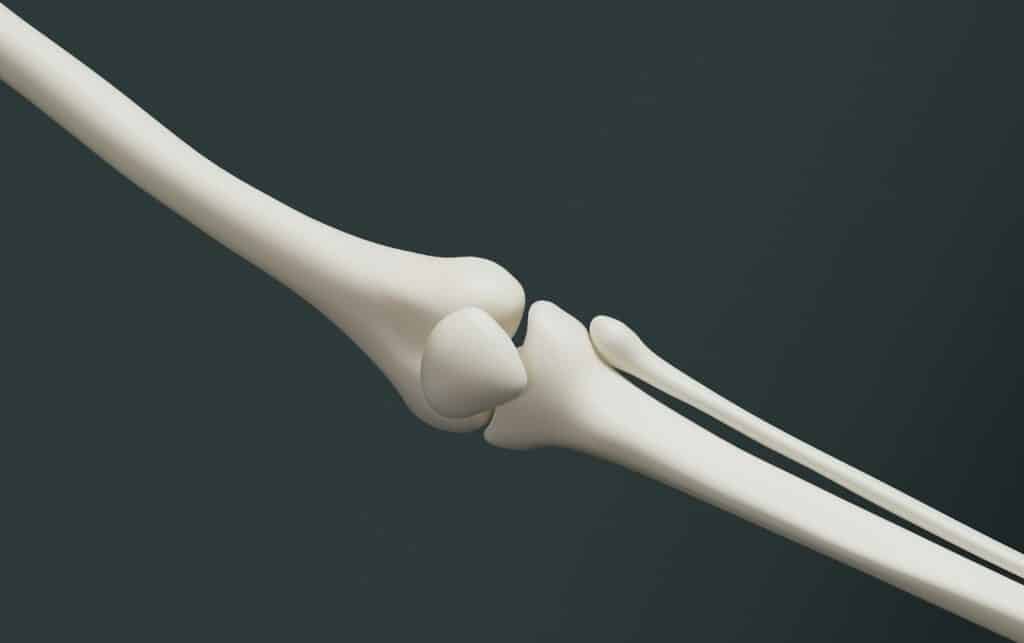 A picture of an arm joint.
