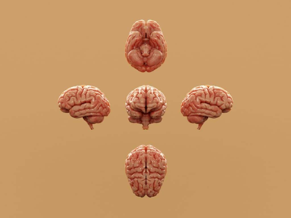 A picture of a human brain
