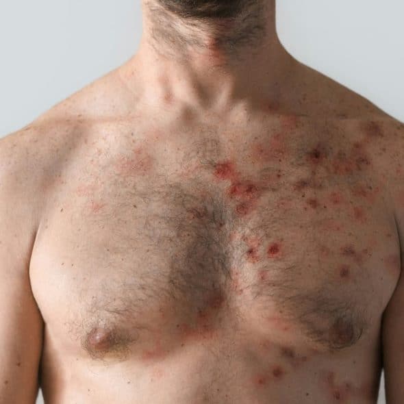 A man having a skin problem