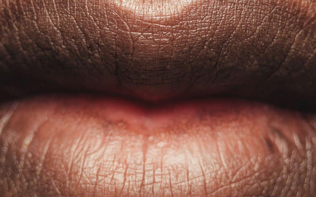 A close-up picture of a dry lips