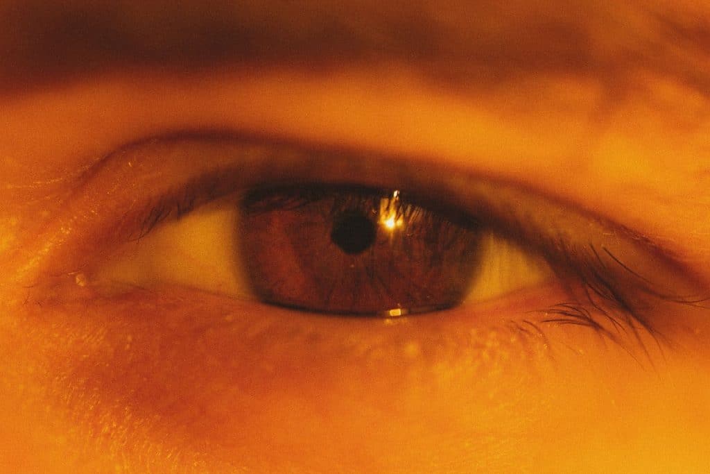 A picture of a person with yellow skin