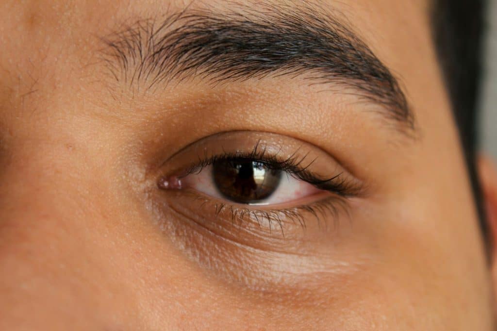 A picture of a man’s eyes with dark circle
