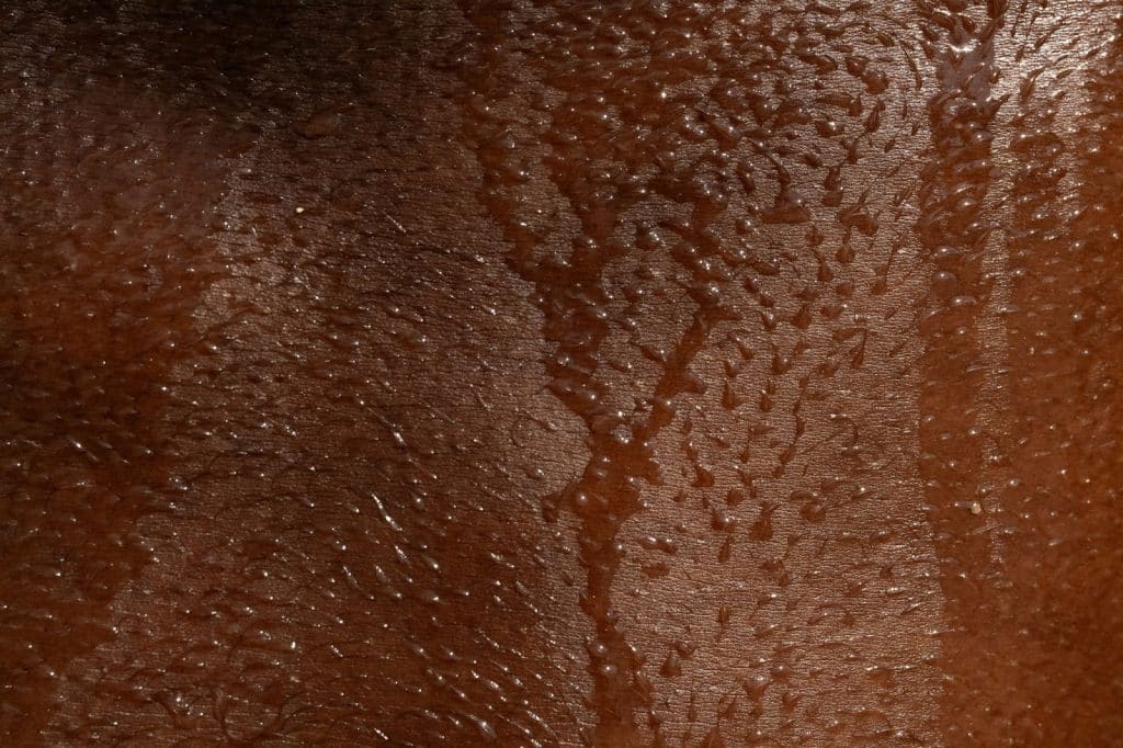 A close-up picture of a skin