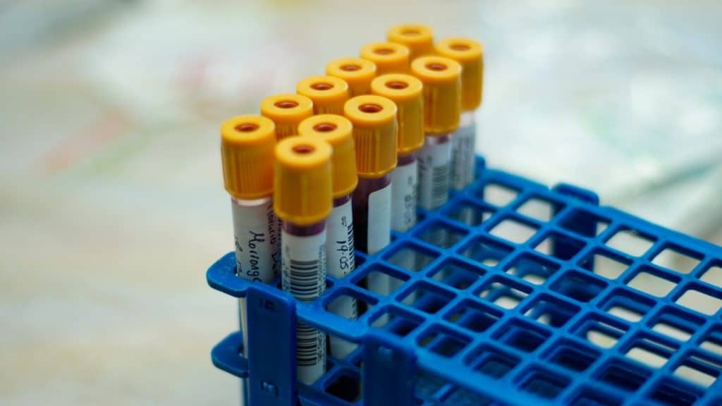 A blue rack holds multiple sample tubes with yellow caps and handwritten labels.