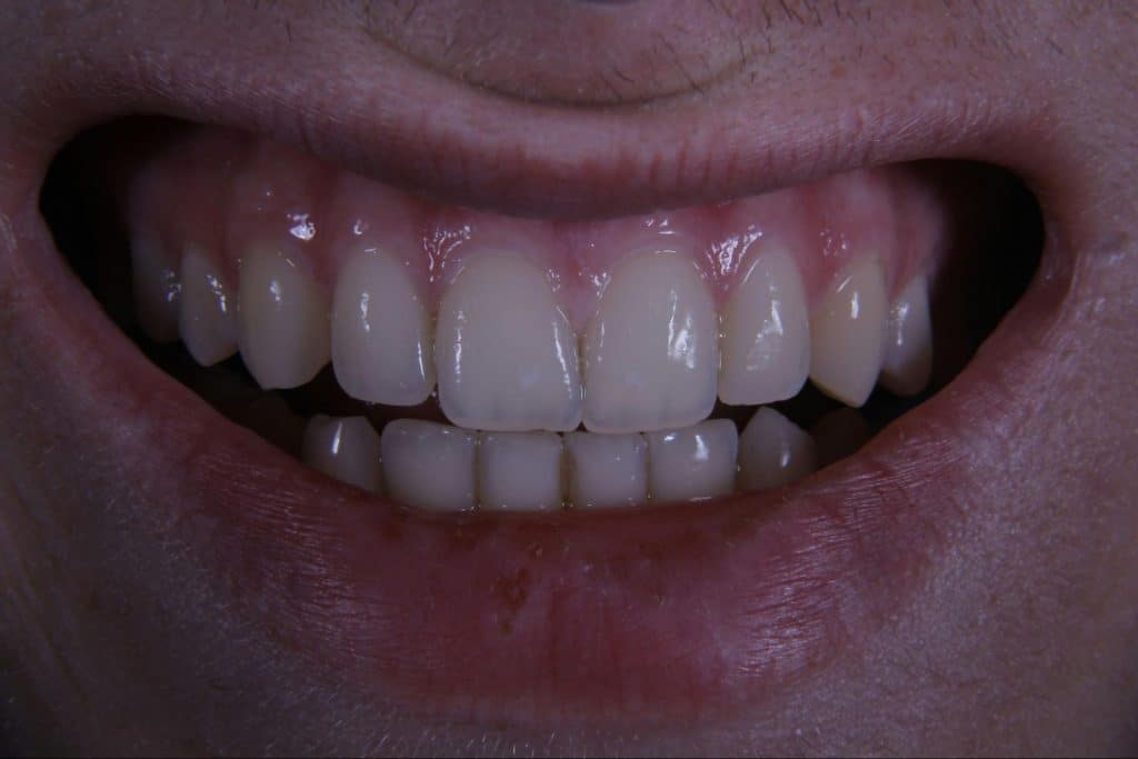 A white teeth of a man