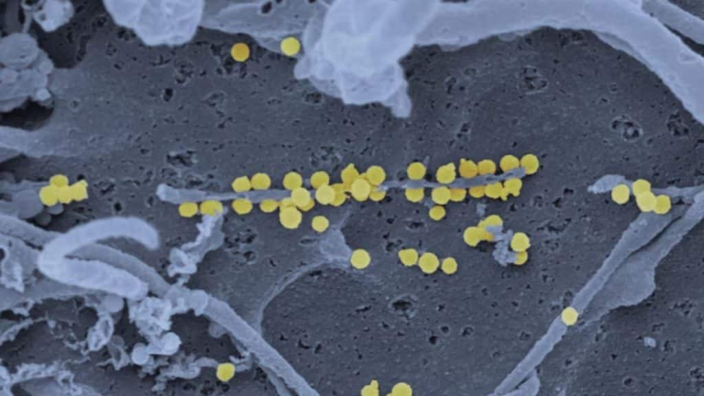 Microscopic view of harmful gut bacteria overgrowth.