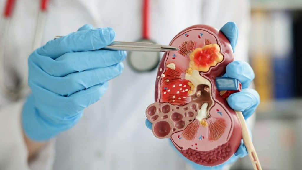A close-up shows gloved hands pointing to a kidney model.