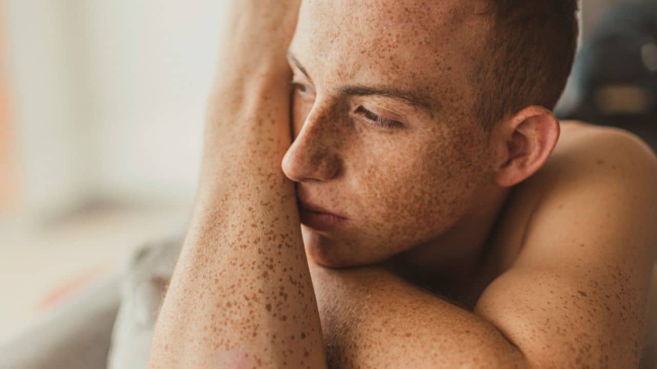 A person with freckles is resting their head on their forearms, looking away.
