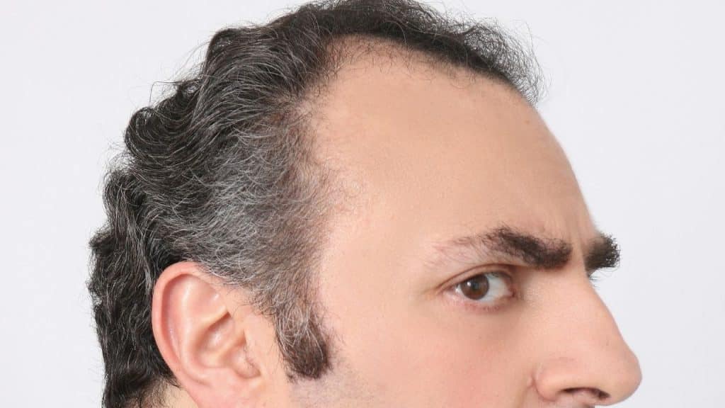 A man's profile shows a receding hairline and an angry expression.