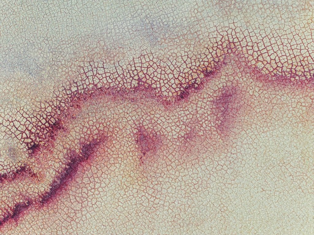 A picture of mocked-up bruise