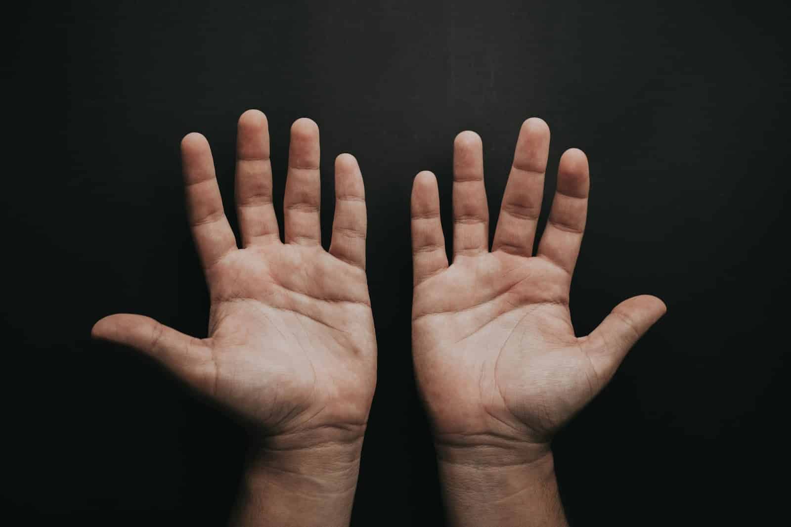 A picture of a man’s hand.