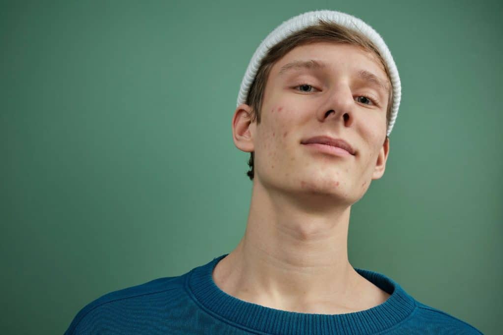 A man with a pale skin