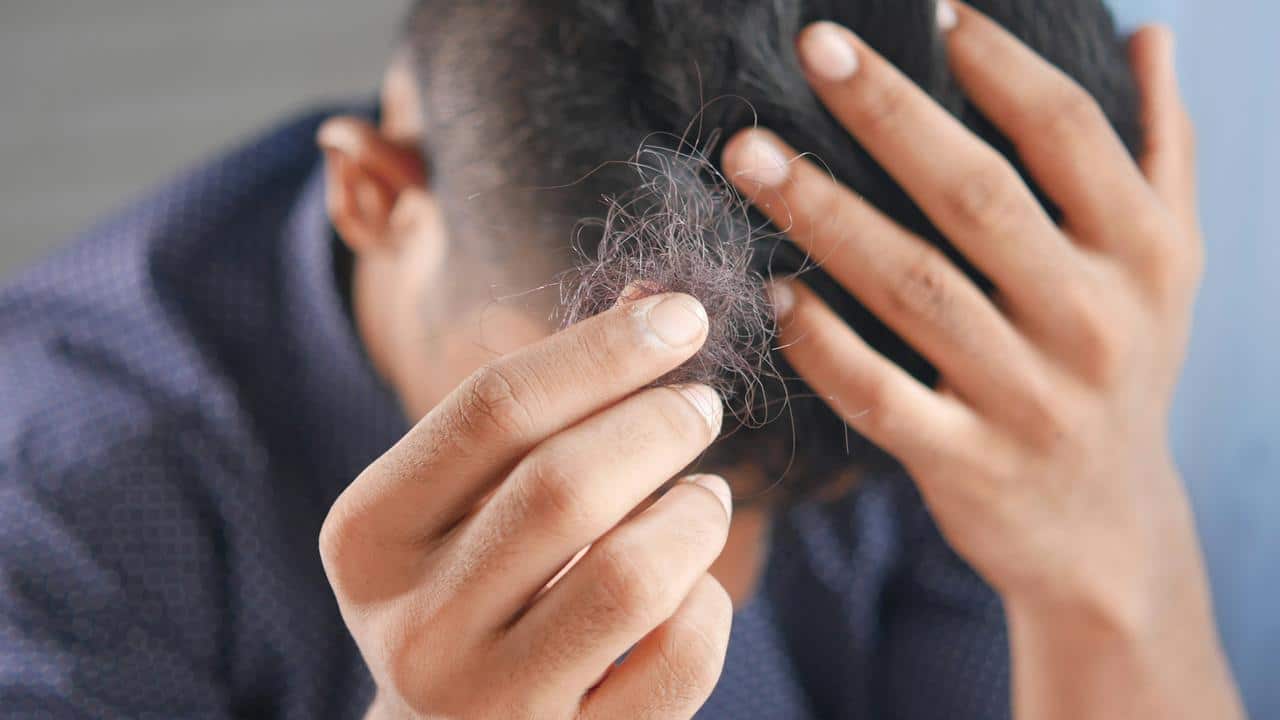 A person holding a clump of fallen hair.