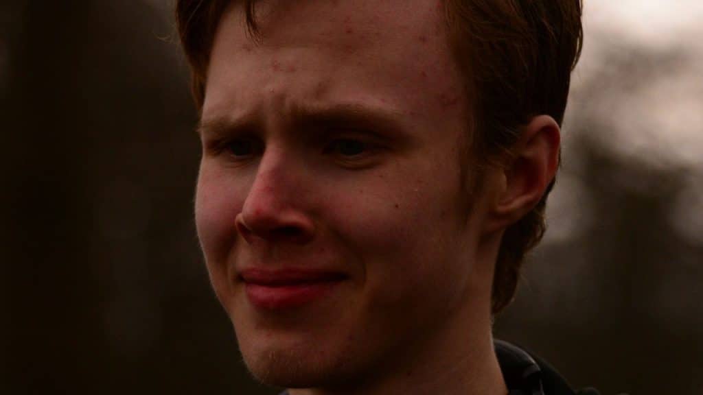 A close-up of a young man with a slight frown and teary eyes.