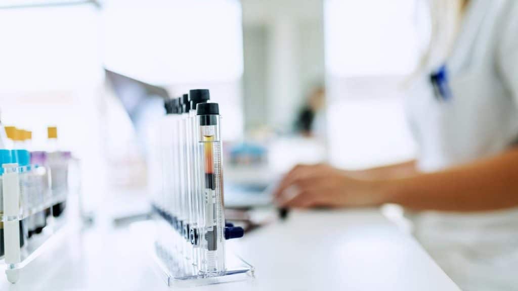 A row of test tubes in a laboratory setting.