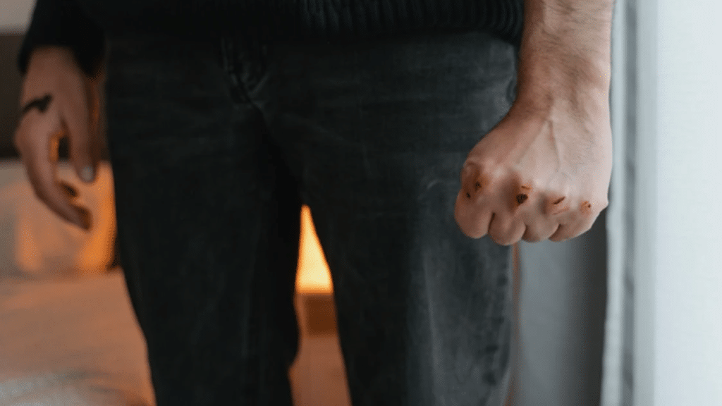 A man with wounds on his closed fist 