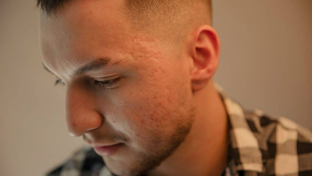 A man in a checkered shirt looks downward with his head slightly tilted.