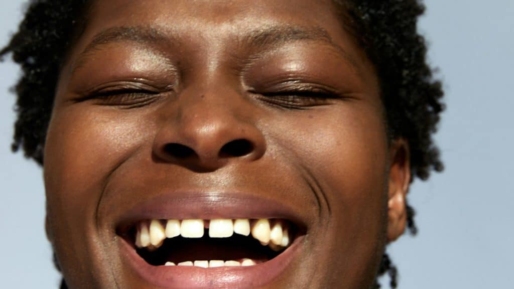 Closeup of a woman with gap between her teeth.