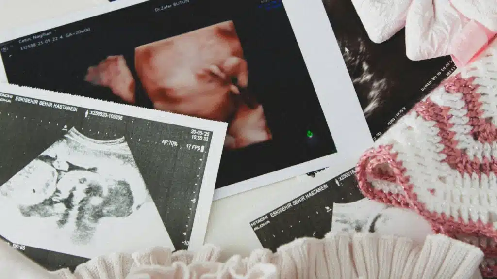 Several printed ultrasound photos lie on a surface next to pink and white knitted clothes.