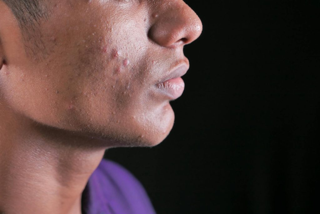 person with inflammation